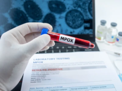 Detalhe de tubo de ensaio contendo líquido vermelho, com etiqueta marcando 