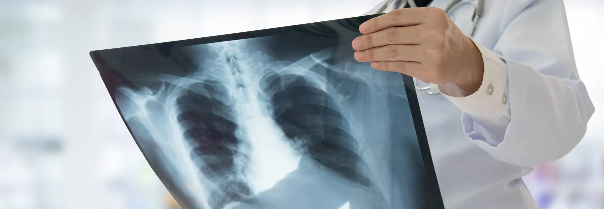 Médico segurando foto raio-x de um pulmão